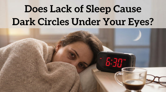 Does Lack of Sleep Cause Dark Circles Under Your Eyes?